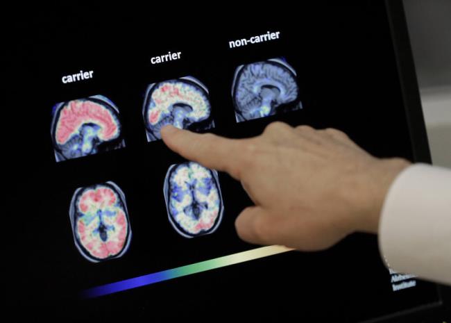 FILE - In this Aug. 14, 2018 file photo, a doctor looks at PET brain scans in Phoenix. (AP Photo/Matt York, File)