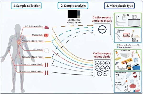 Microplastics found in human heart tissues, both before and after surgical procedures